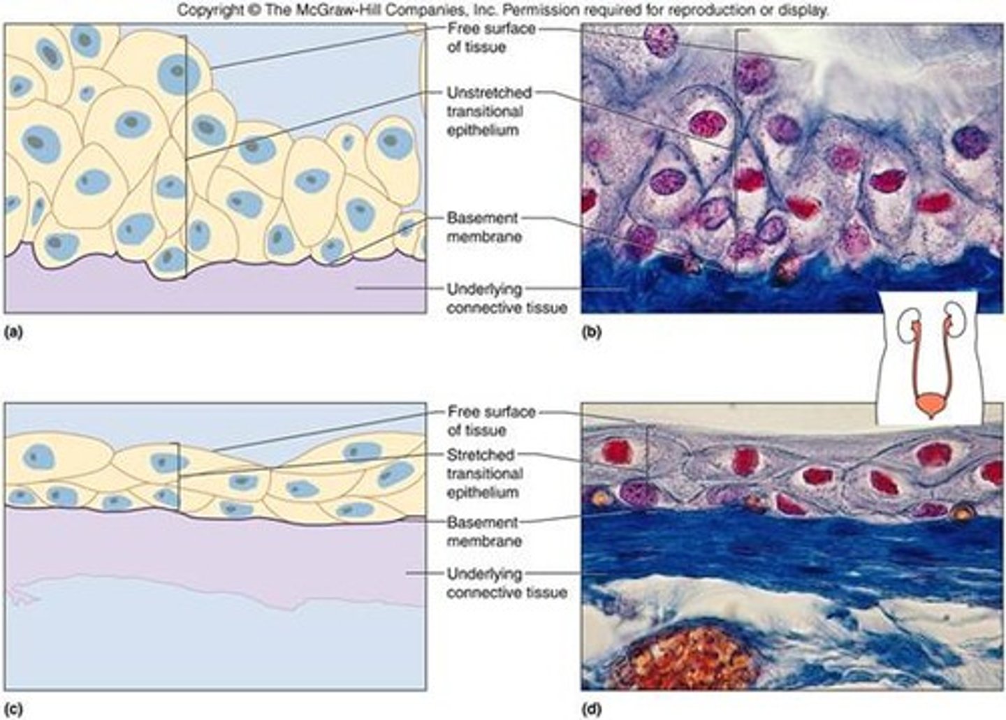 <p>Multiple layers of epithelial cells which can contract and expand in order to adapt to the degree of distension needed.</p><p>Function: stretches readily and permits distension of urinary organ by contained urine</p><p>Location: lines the ureters, urinary bladder, and part of the urethra.</p>