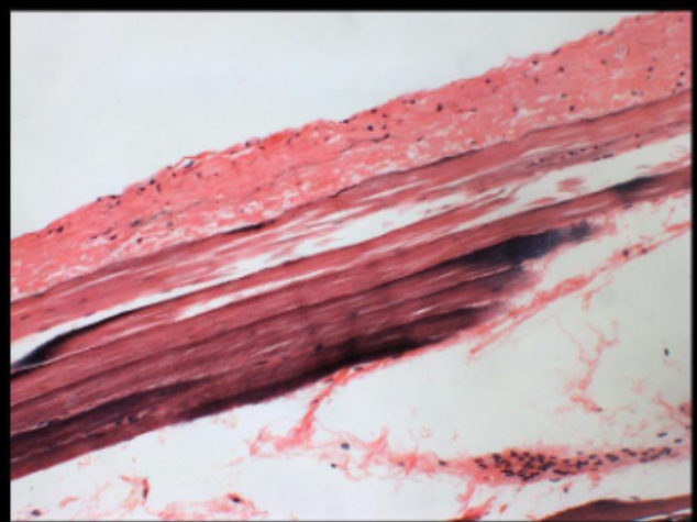 <p>Striated Muscle (200x)</p>