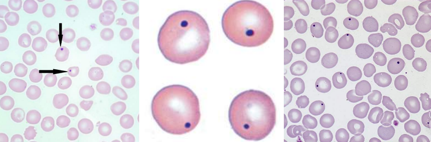 <p>A. Identify the cell<br>B. Identify the disease / condition<br>C. Composition of Inclusion</p>