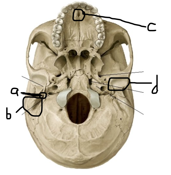 <p>What is letter d?</p>