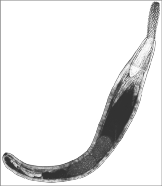 <p>Thorny-headed worms</p>