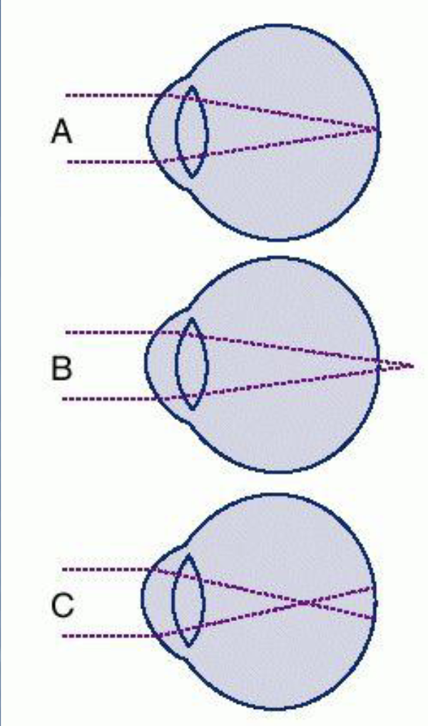 <p>Figure C is a demonstration of what?</p>