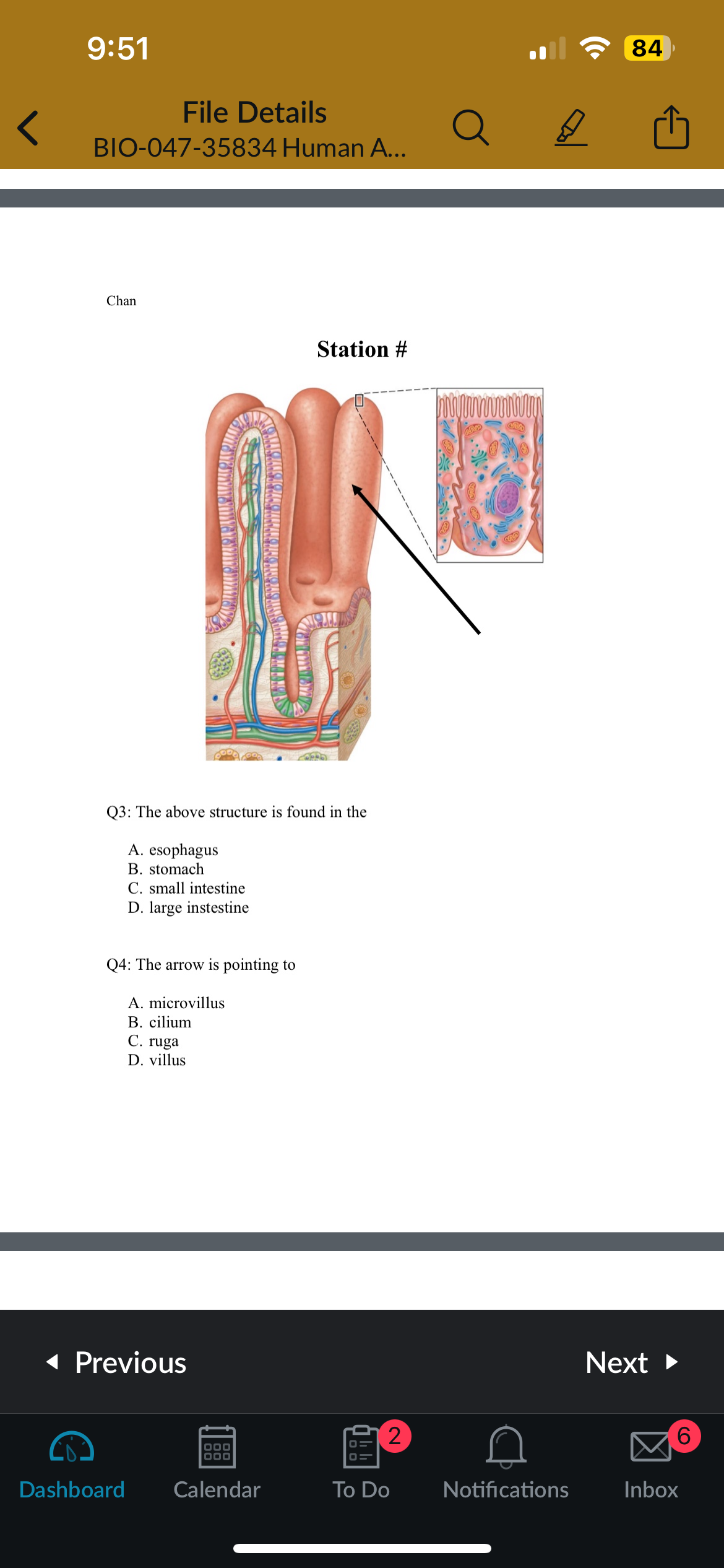 <p>Q3: The above structure is found in the</p>