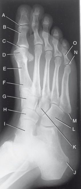 <p>N is:</p>