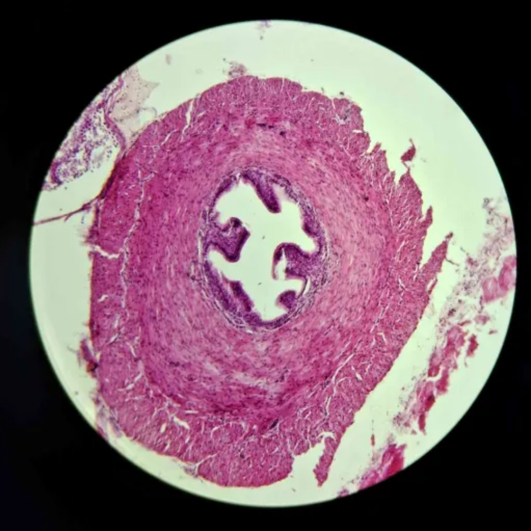 term image