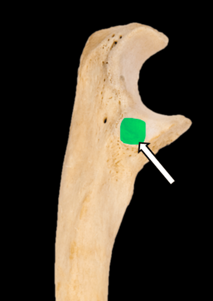 <p>name the part</p>
