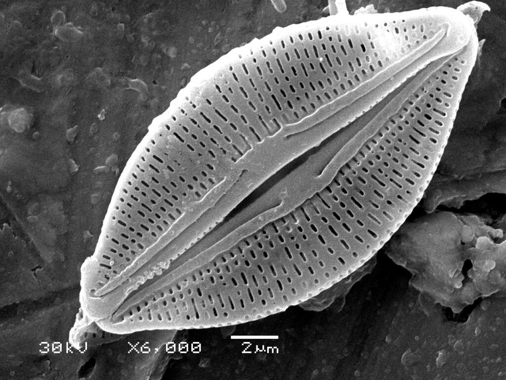 <p>Photosynthetic protist that occurs singly or in chain formation </p><p>→ 2-200 microm </p><p>→ encased in silica shell w/ two valves</p><p>→ radially symmetrical  </p>