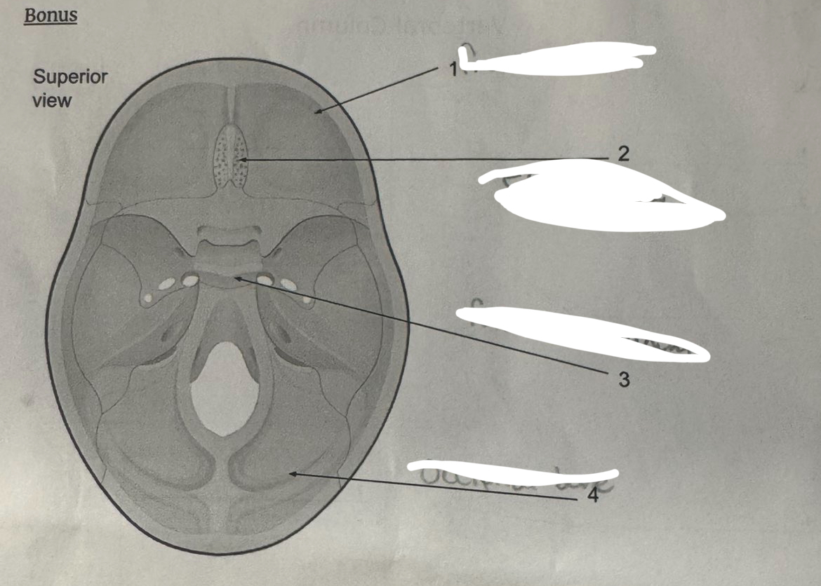 <p>what bone is labled by #4</p>