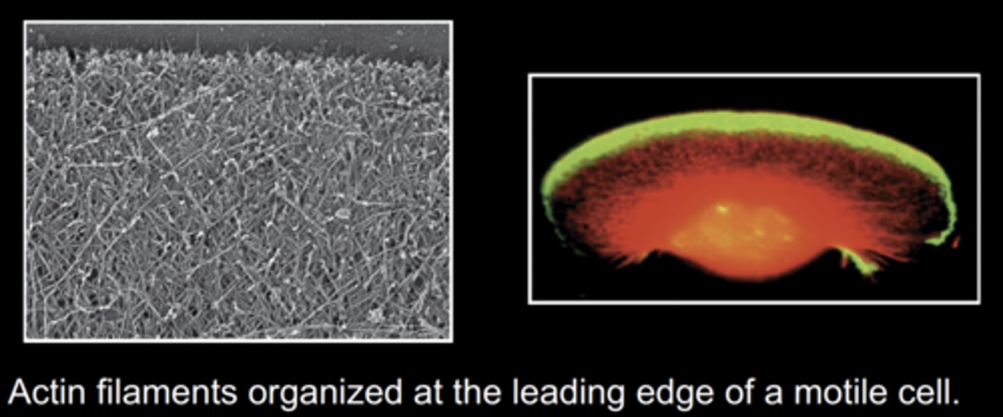<p>actin filaments</p>