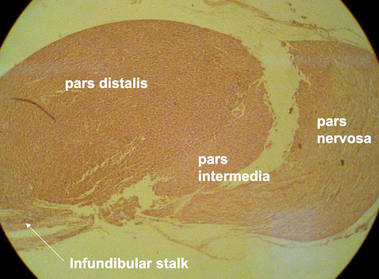<p>What is the overall structure being observed in this cross section?</p>