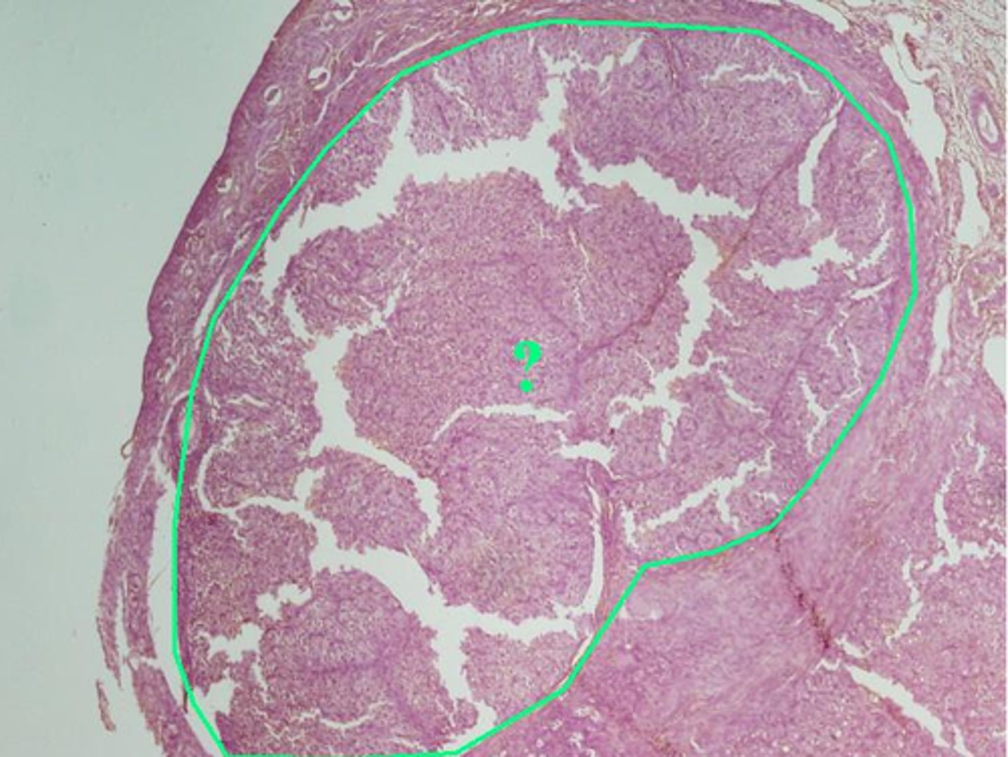 <p>Identify the indicated structure within the ovary.</p>