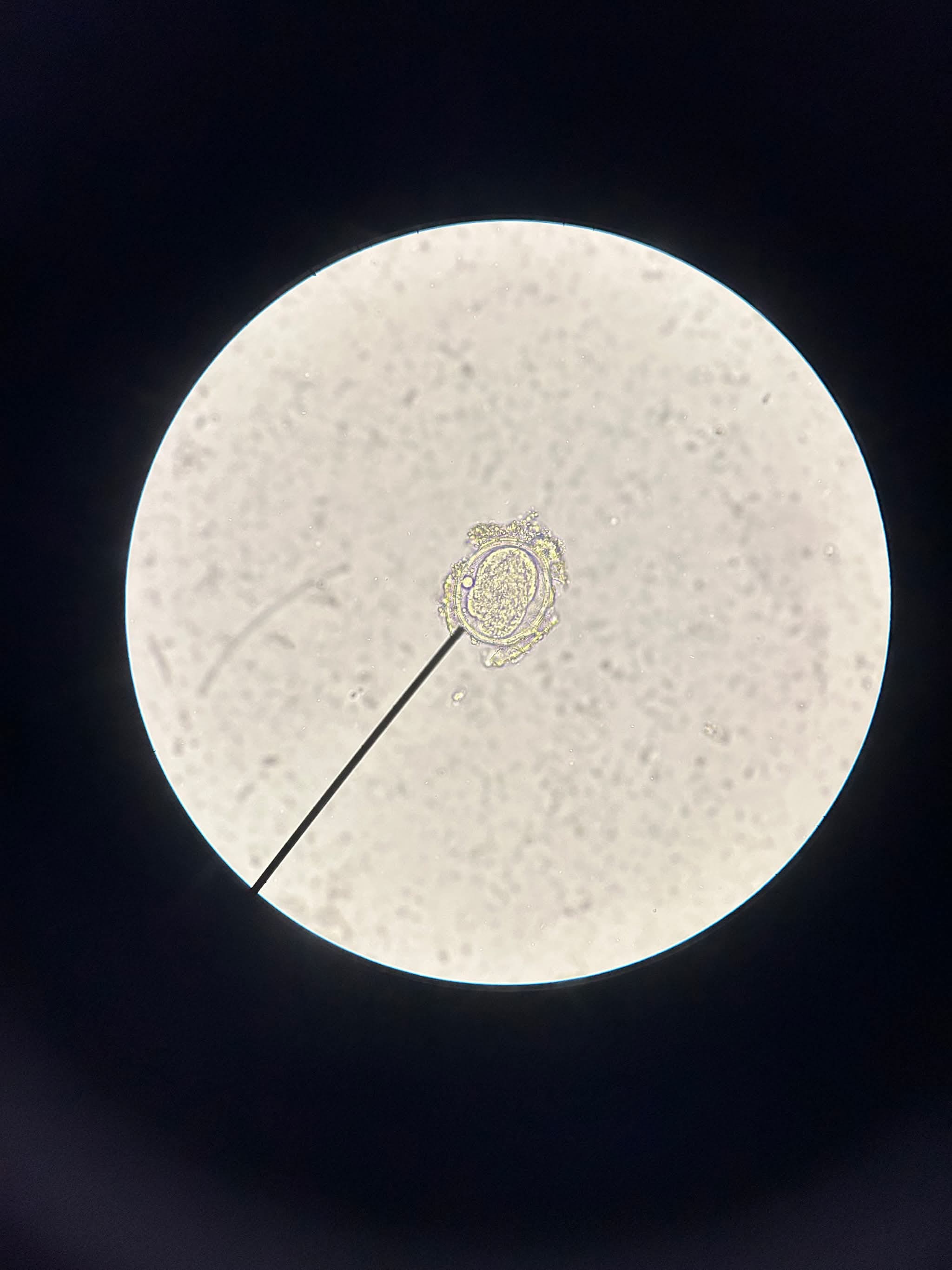 <p>Ascaris lumbricodes,</p>