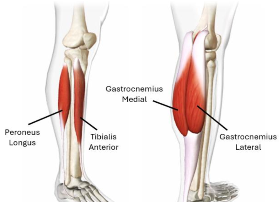 <p>Gastrocnemius muscle and tibialis anterior muscle </p>