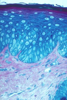 <p>what type of epithelium is this </p>