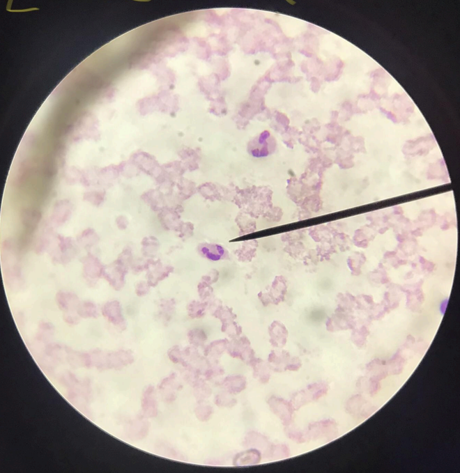 <p>RBC - flat cells with bioconcave discs devoid of nuclei/carriers of oxygen and carbon dioxide in the blood; WBC - lack of color, true cells with nucleus, divided to 2 groups: non-granular/agranulocytes and granular/granulocytes</p>