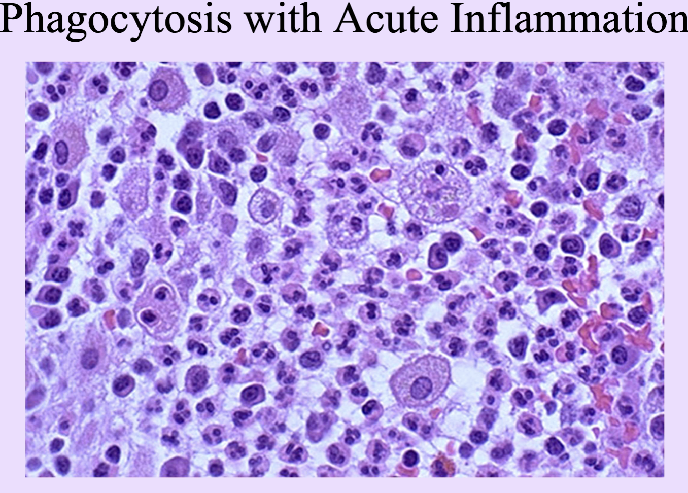 <p>Molecules (e.g., Ig, C3b) that tag pathogens to enhance phagocytosis.</p>