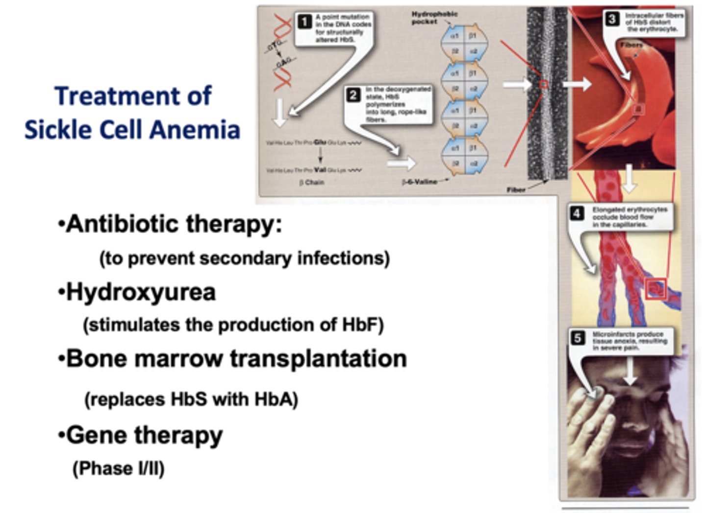 <p>- Antibiotic therapy</p><p>- Hydroxyurea</p><p>- Bone marrow transplant</p><p>- Gene therapy</p>