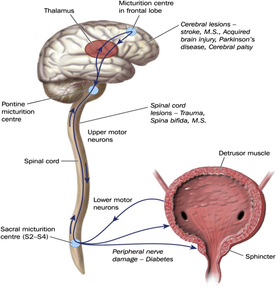 <p>-bladder disorder, postrenal</p><p>-detrusor overactivity</p><p>-urinary urgency and urodynamic testing</p><p></p><p></p>