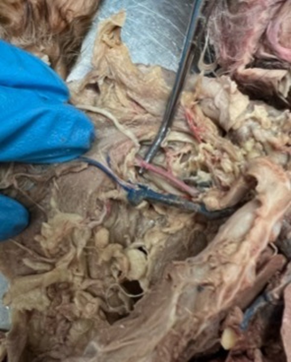 <p>the name of the axillary artery after it enters the arm</p>