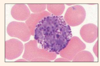 <p>Identify the blood cell</p>