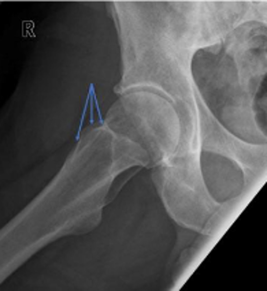 <p>What are the arrows pointing to?</p>