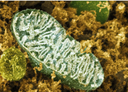 <p>what kind of microscope is this image from </p>
