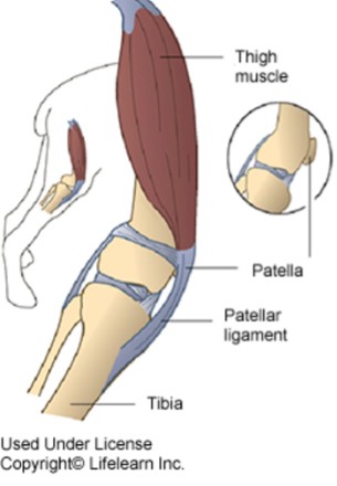 <p>What is a 4-headed muscle that extends the stifle, made up of vastus lateralis, vastus medialis, vastus intermedius, and the rectus femoris?</p>