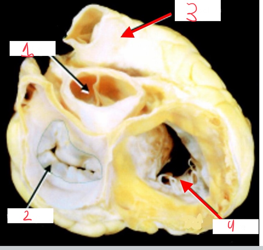 <p>What valve is 2 pointing to?</p>