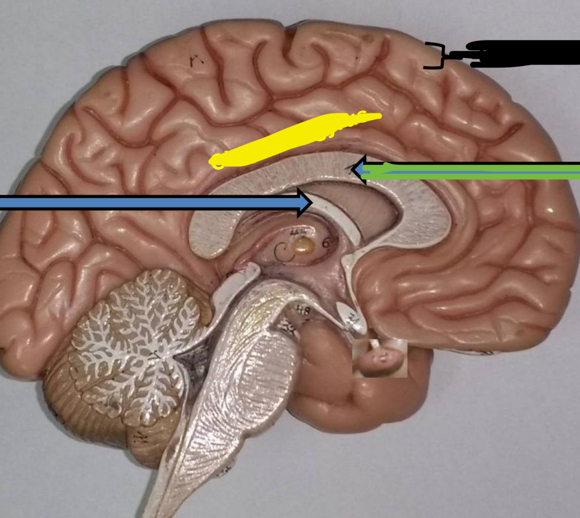 <p>Black is what part of the cerebrum</p>