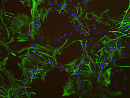 c-fos staining