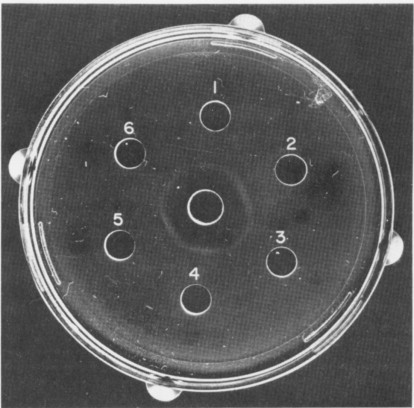 <ul><li><p>Antigen test</p></li><li><p>Quantative </p><ol><li><p>Add patient serum to the hole</p></li><li><p>The serum will diffuse out</p></li><li><p>If it’s positive, it will cause rings to form</p><ul><li><p>Thicker rings, mean higher concentration</p></li></ul></li></ol><p></p></li></ul><p></p>