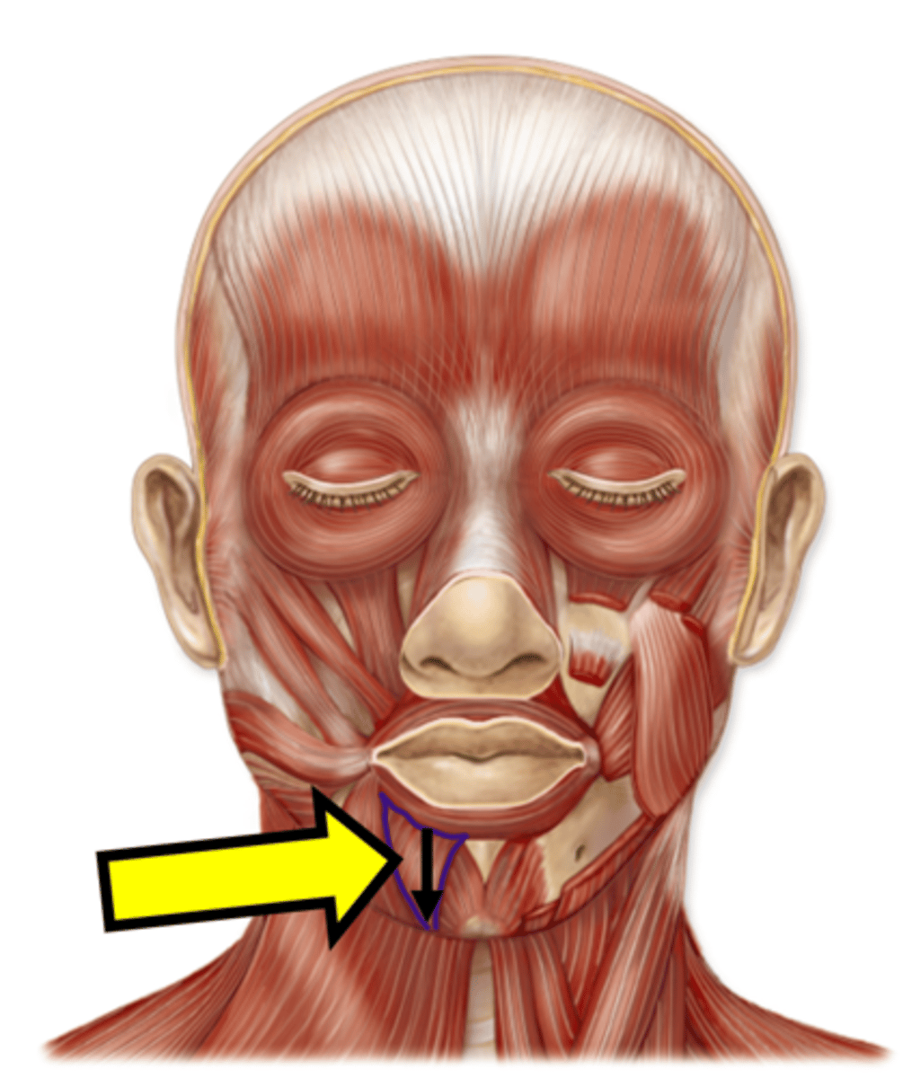 <p>Name the muscle.</p>