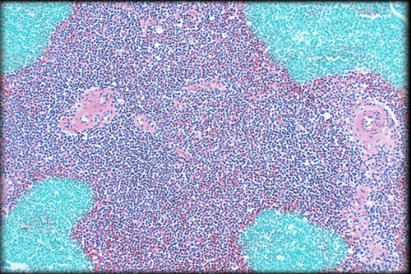 <p>Spleen</p>