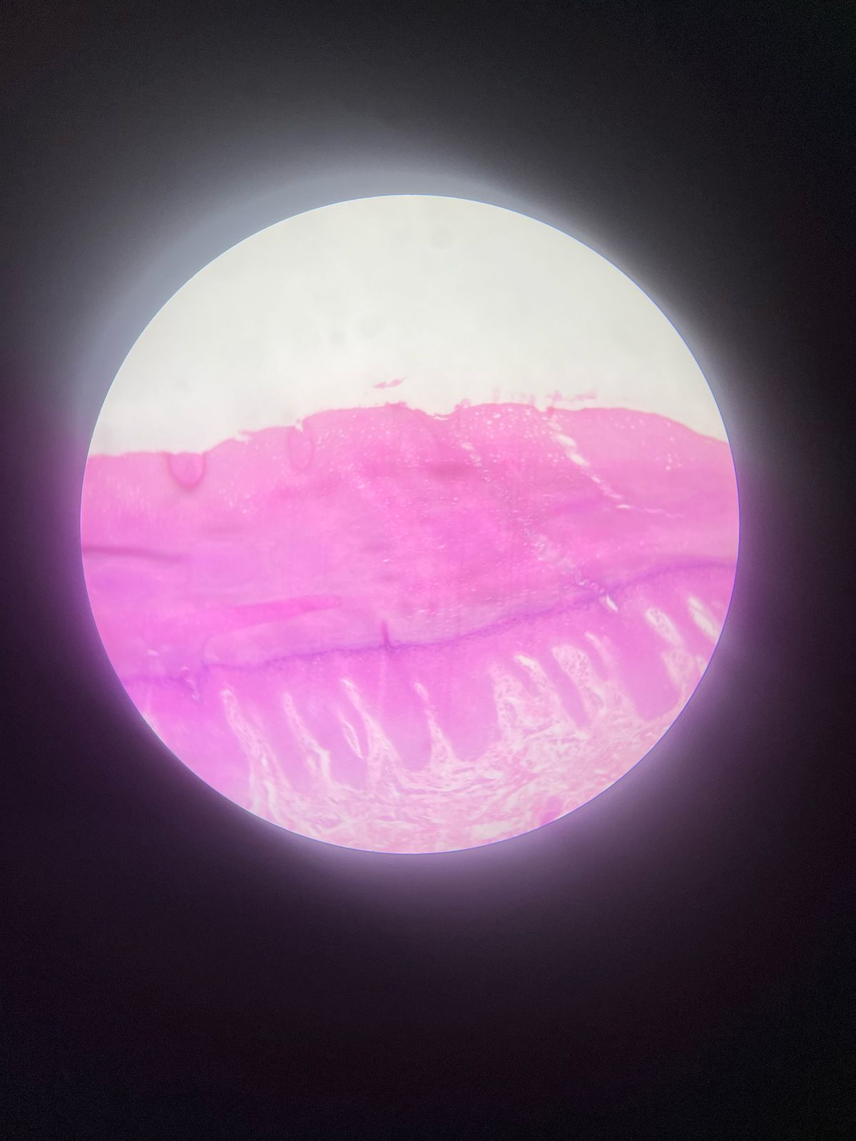 term image