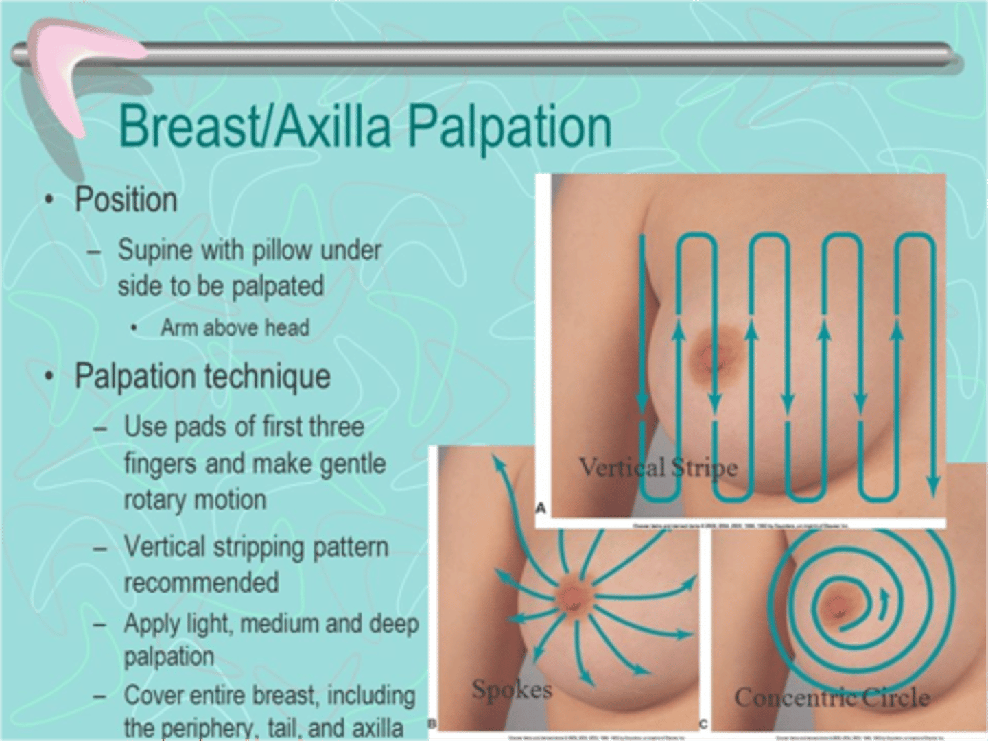 <p>a. Woman sitting up facing examiner</p><p>b. During palpation when woman is supine, cover one breast with gown while examining other</p><p>Equipment</p><p>-Small pillow</p><p>-Ruler marked in centimeters</p><p>-Pamphlet or teaching aid for breast self-examination (BSE)</p>