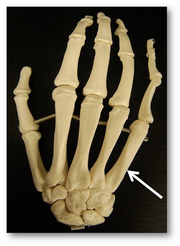 Name this specific bone of the hand (posterior view).