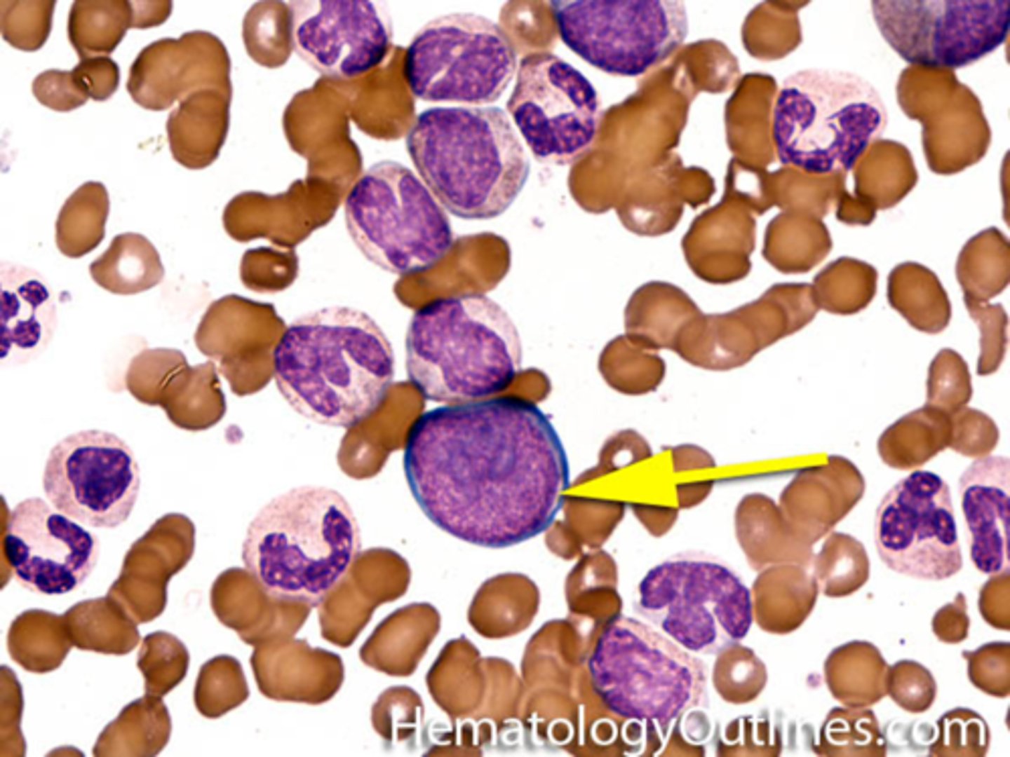 <p>small amount of blue agranular cytoplasm with a distinct unstained area adjacent to the nucleus (Golgi apparatus).</p>