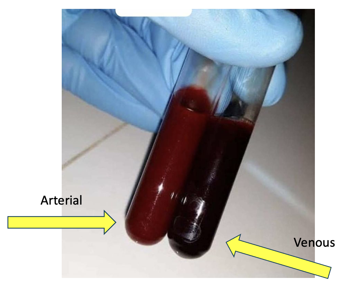 <p>Cardiovascular System</p>
