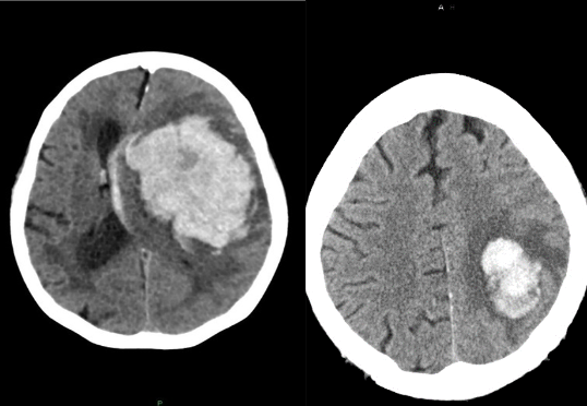 <p>What is this pathology?</p>