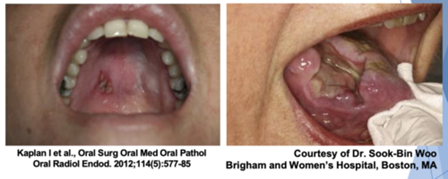 <p>ID the pathology:</p>