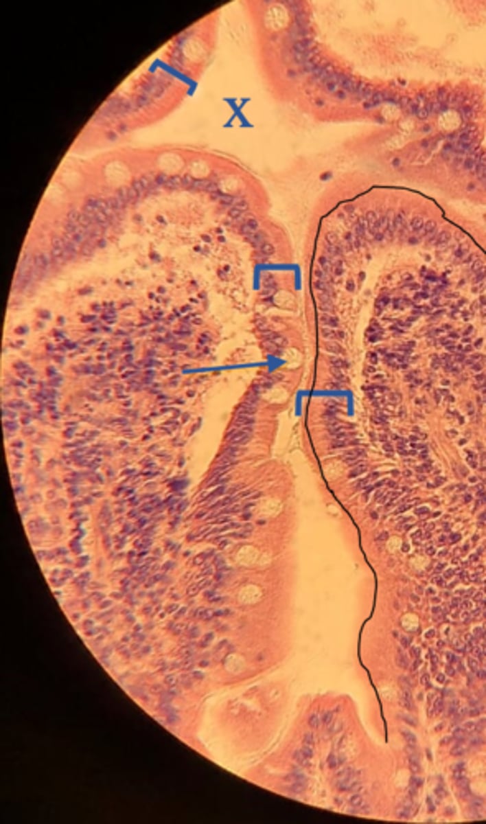 <p>Name the cell at the arrow.</p>