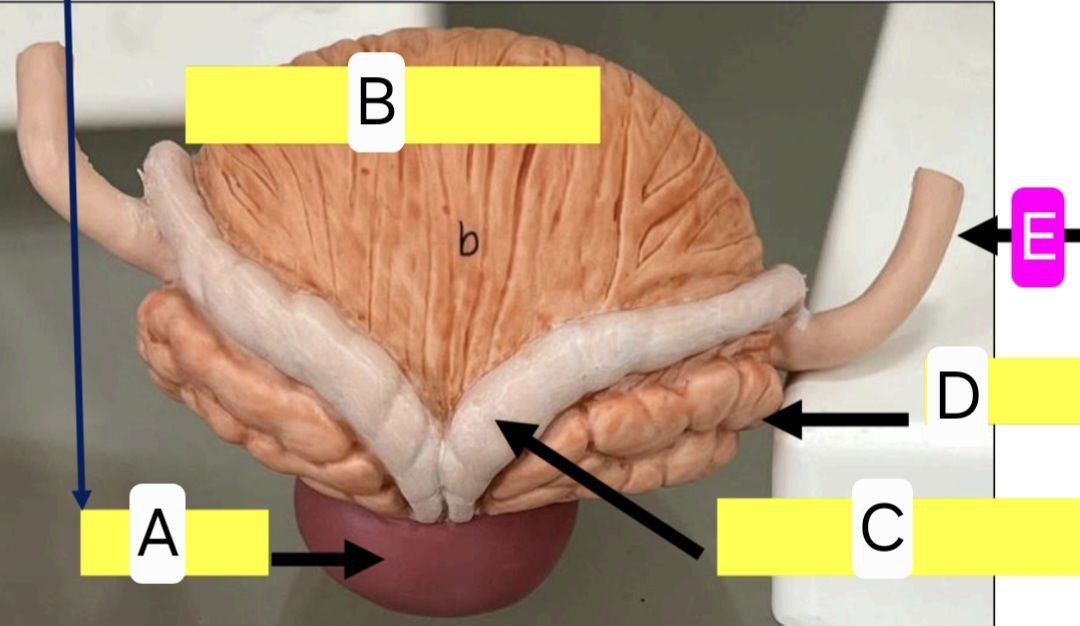 <p>Identify the following and answer these questions</p><p></p><ul><li><p>Function of A</p></li></ul><p></p><ul><li><p>Termination of C and D</p></li></ul><p></p><ul><li><p>termination of E</p></li></ul><p></p>