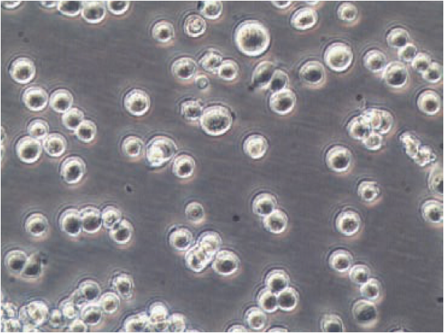 <p><span>anchorage-independent growth</span></p><p><span>immune cells</span></p><p><span>suspension </span></p>