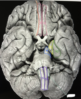 <p>What is the white?</p>