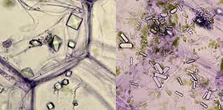 <p>What plant crystals are shown below?</p>