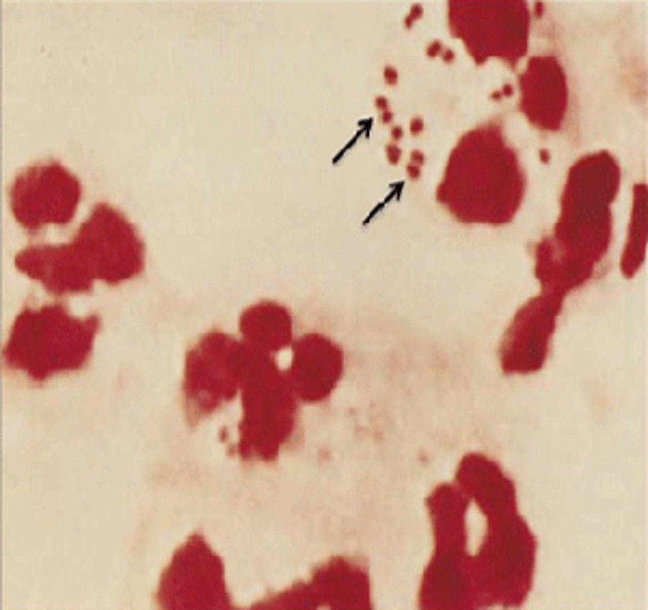 <p>meningococcus</p>