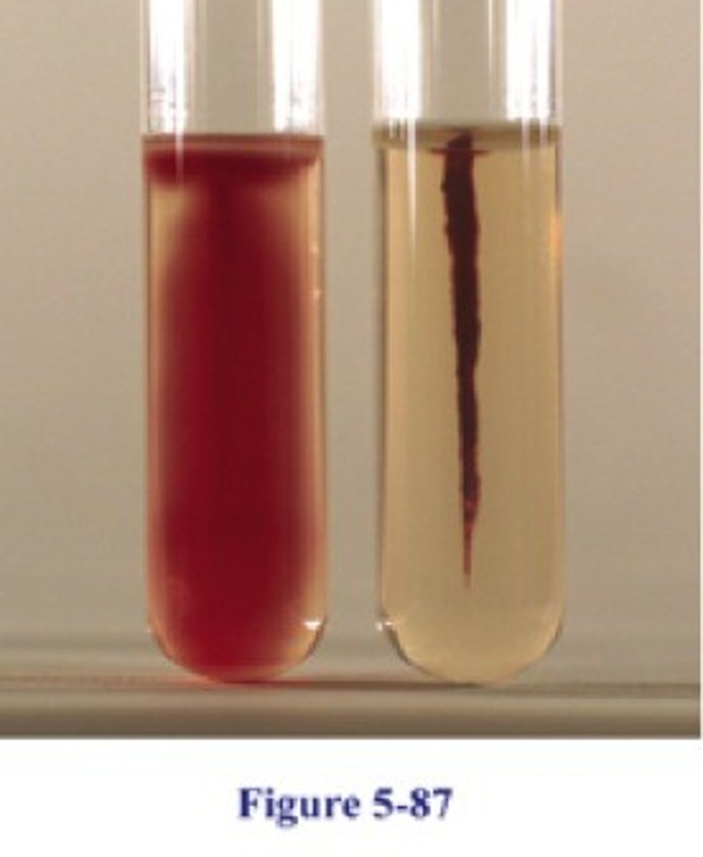 <p>tubes of solid agar with bacteria stabbed into the media, used for storage up to 1 yr</p>