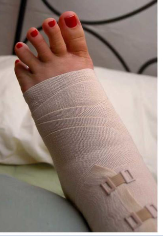 <p>what is the name, type, and purpose of this orthotic </p>