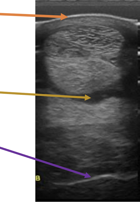 <p>What is the yellow arrow showing?</p>