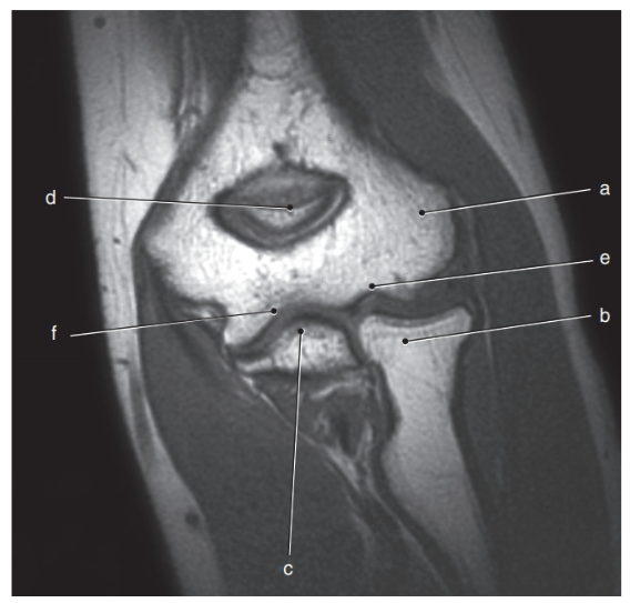 <p>What is letter a ?</p>